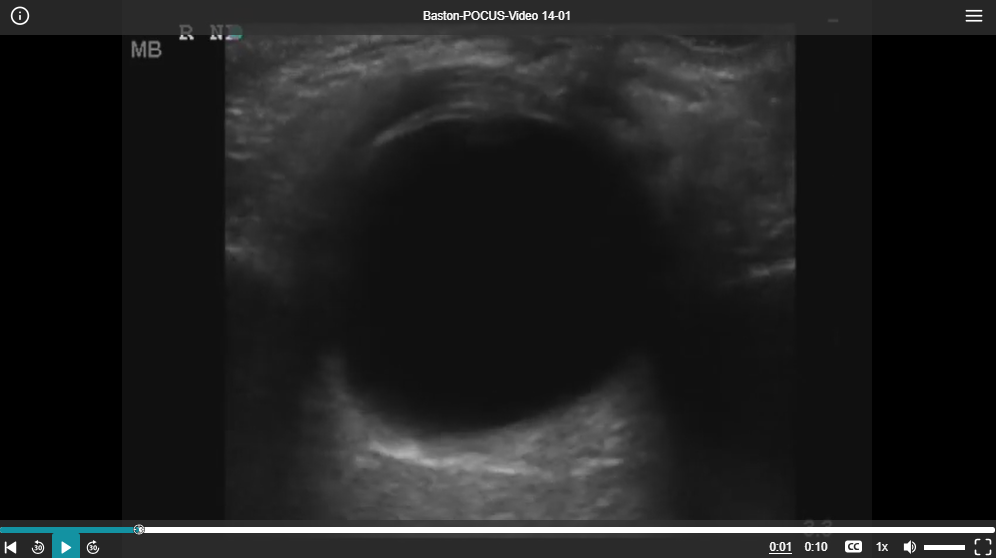 ocular
